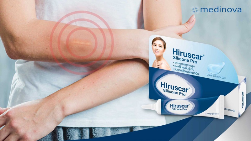 Góc giải đáp: Sản phẩm Hiruscar có trị sẹo lồi không? 2