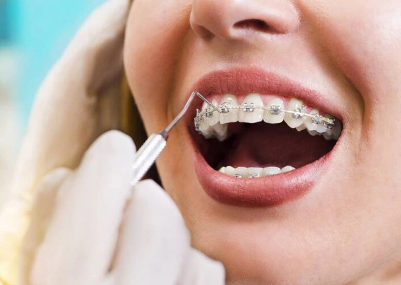 Thường xuyên thăm khám bác sĩ nếu răng có tình trạng bị tụt lợi