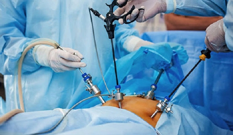 Giải đáp: U nang buồng trứng uống thuốc gì nhanh khỏi 3