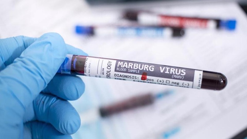 UBND TP.HCM yêu cầu tăng cường giám sát phòng, chống dịch bệnh Marburg - Hình 3