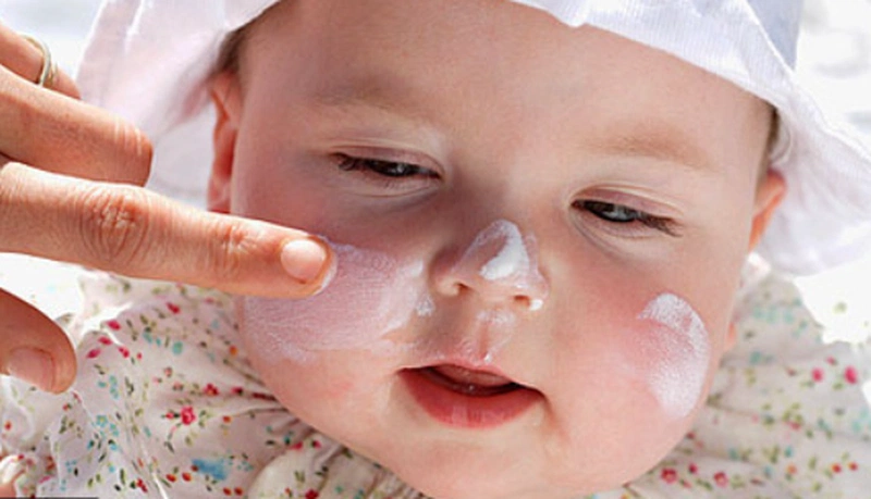 Ung thư da ở trẻ em có triệu chứng gì, điều trị và phòng ngừa như thế nào? 3