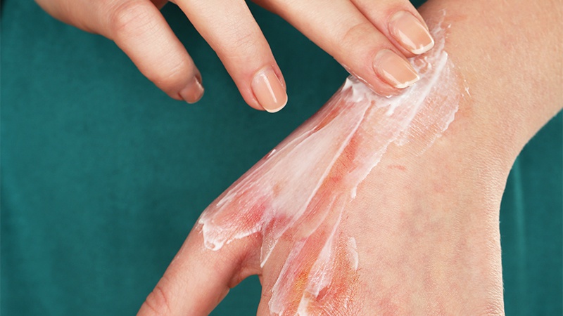 Uốn ván tác hại khôn lường - Cảnh giác từ những vết thương siêu nhỏ 3