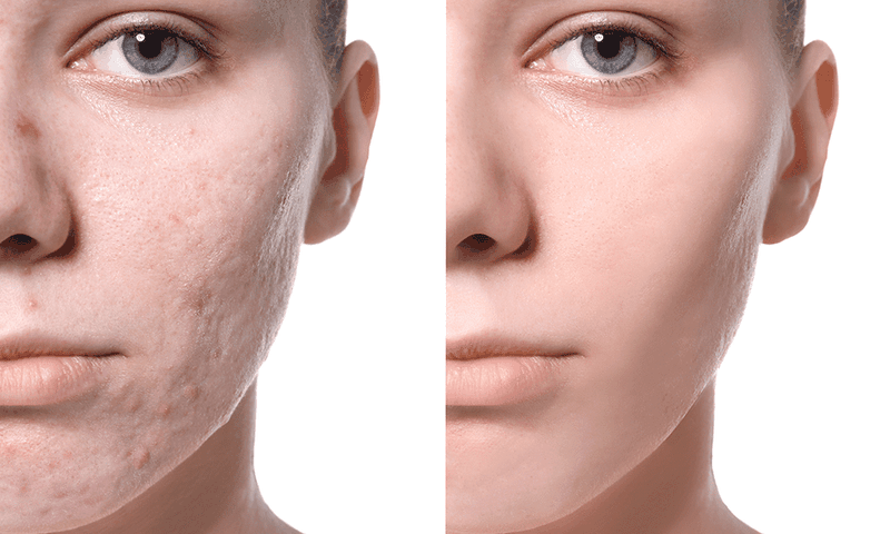 Uống collagen ngày mấy viên là tốt nhất - Bạn đã biết chưa? 2