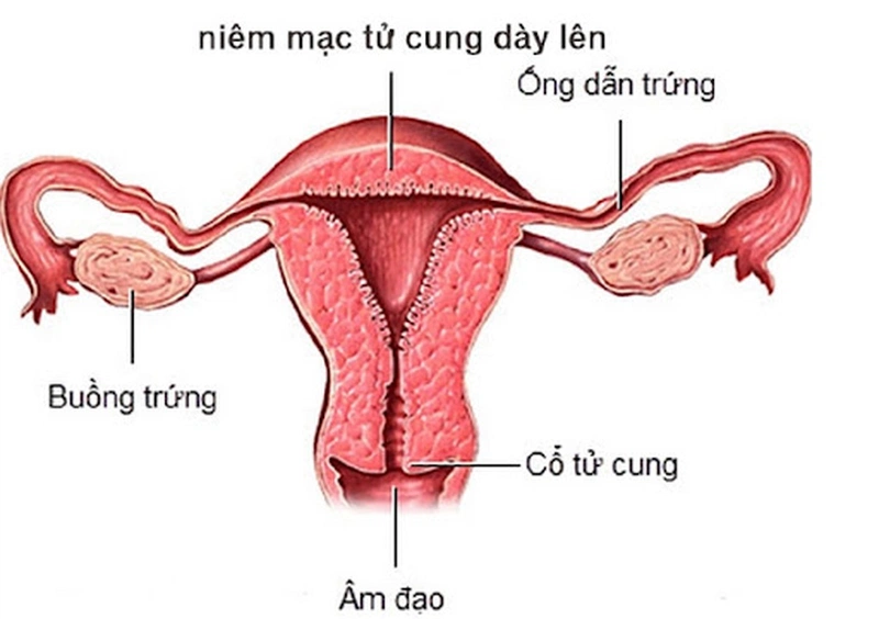 Những thông tin chia sẻ về vấn đề uống tam thất trị lạc nội mạc tử cung mà bạn cần biết