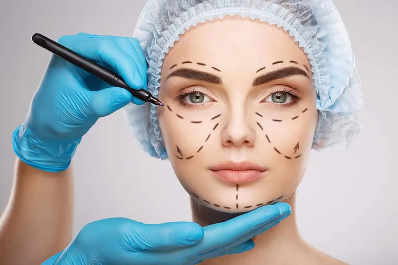 Ưu nhược điểm của phương pháp tiêm filler hạ gò má