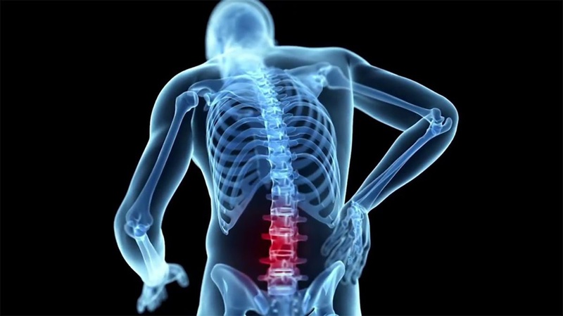 Vật lý trị liệu thoái hóa cột sống lưng1