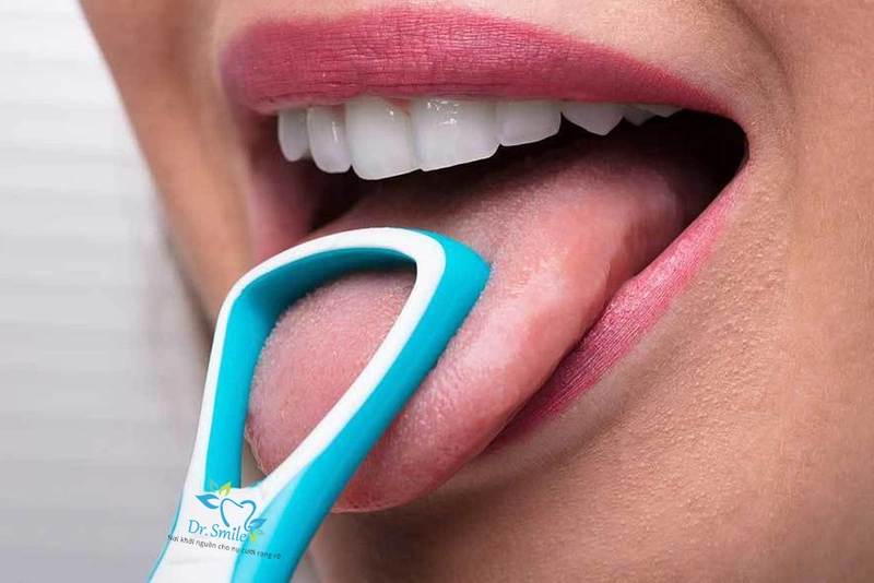 Nguyên nhân và cách điều trị bệnh viêm lợi