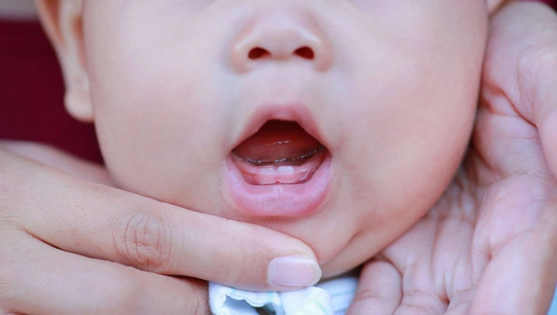 Vệ sinh răng miệng cho bé 10 tháng tuổi: Hỗ trợ tốt quá trình mọc răng 1