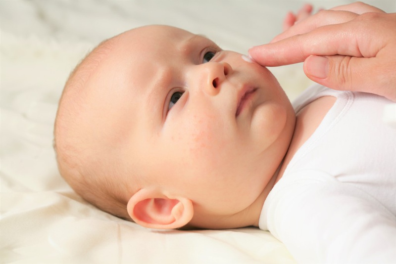 Vết bớt ở trẻ sơ sinh là gì? Có nguy hiểm không? 2