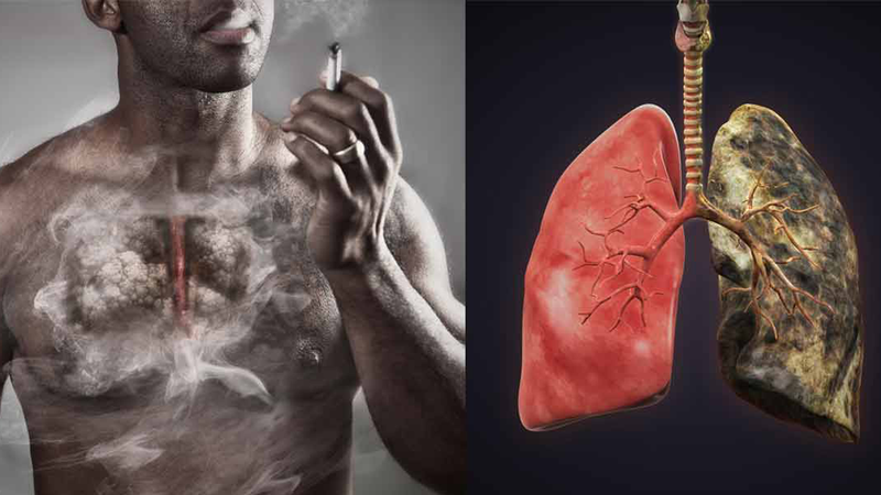 Vì sao hút thuốc lá gây ung thư phổi? 4
