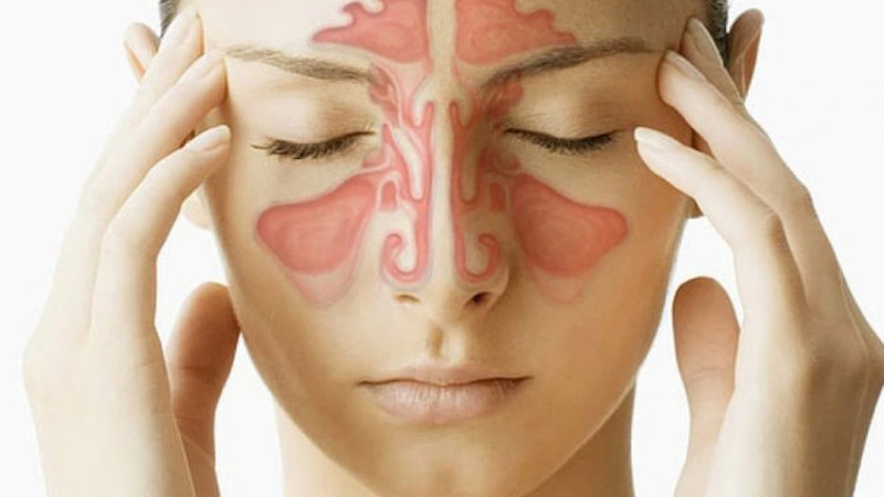 Vì sao mặt bị sưng sau khi ngủ dậy? 3