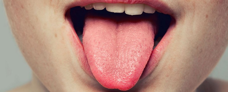 Vì sao miệng có vị mặn? Nguyên nhân và cách chữa trị 1