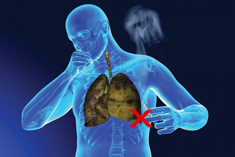 Hút thuốc lá làm suy yếu chức năng phổi và nhiều nội tạng khác trong cơ thể.