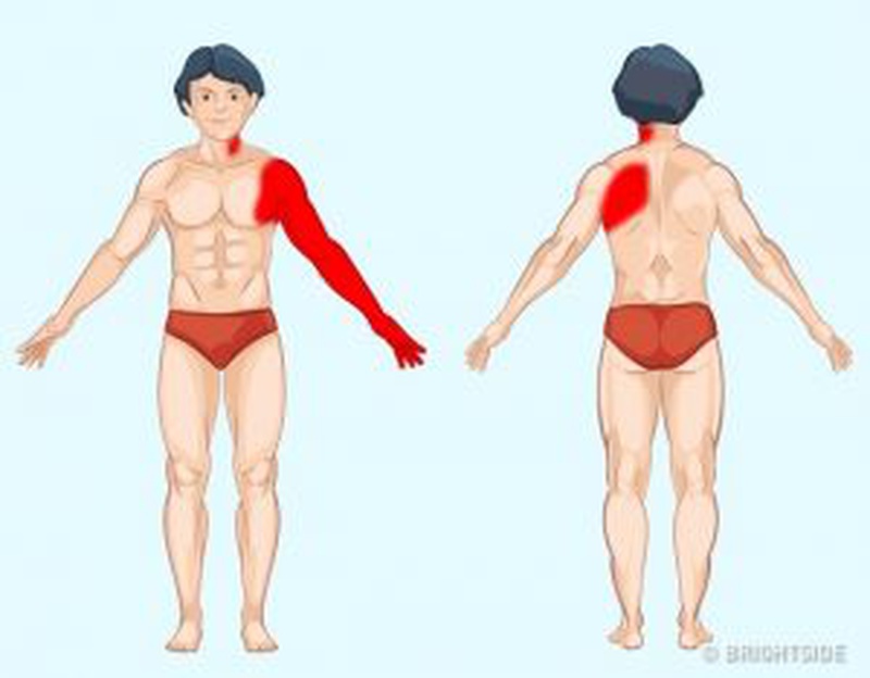 Vị trí đau tiết lộ các vấn đề sức khỏe mà bạn đang gặp phải 1