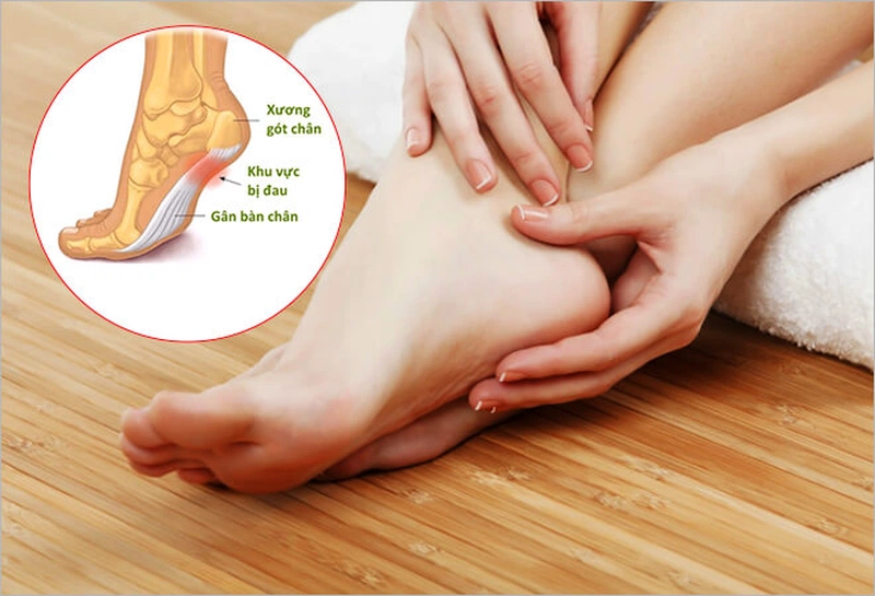 Hướng dẫn các bài tập vật lý trị liệu viêm cân gan bàn chân tại nhà 1