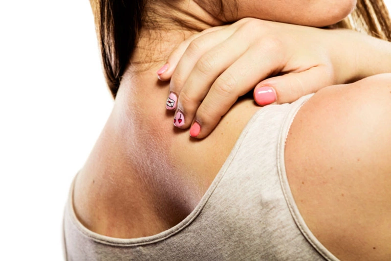 Viêm da dị ứng có để lại sẹo không? Làm cách nào điều trị? 2