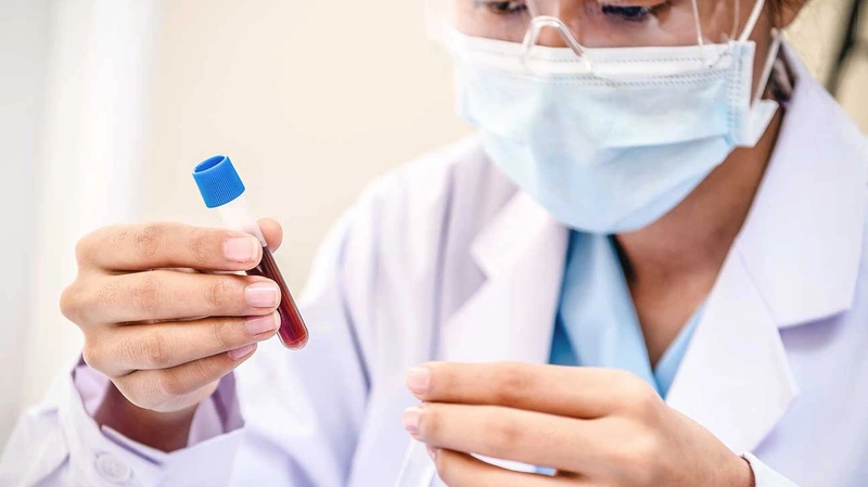 Viêm đại tràng xét nghiệm máu là phương pháp xét nghiệm duy nhất 1
