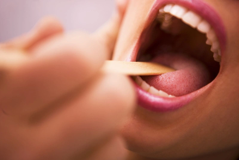 Viêm họng amidan uống thuốc gì nhanh khỏi?