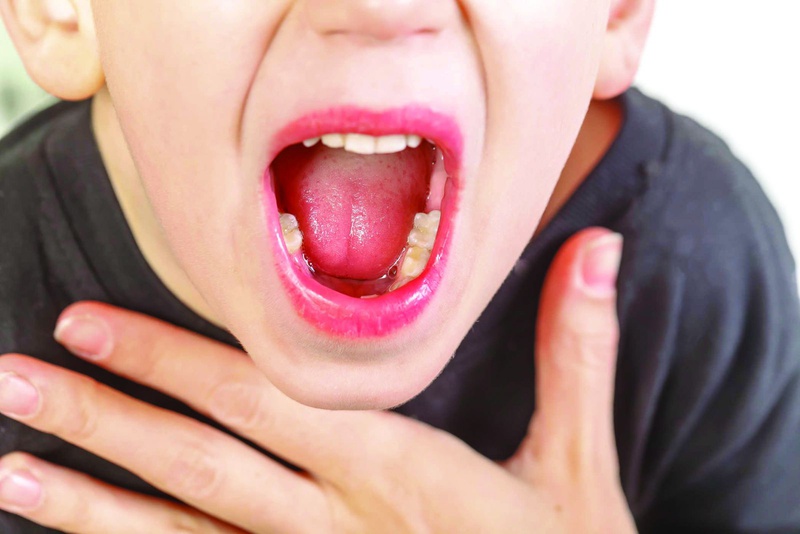 Viêm họng hạch có nguy hiểm không? Làm sao phòng ngừa