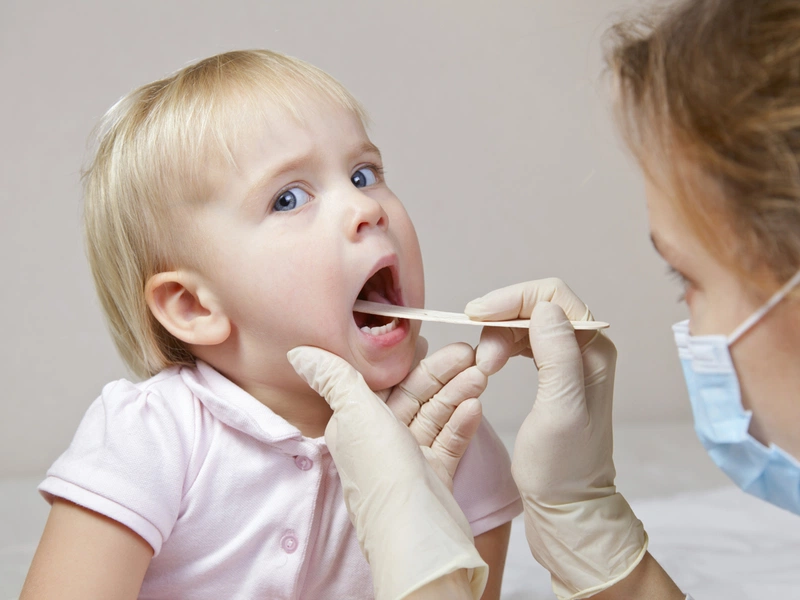 Viêm họng hạt có lây không? 1