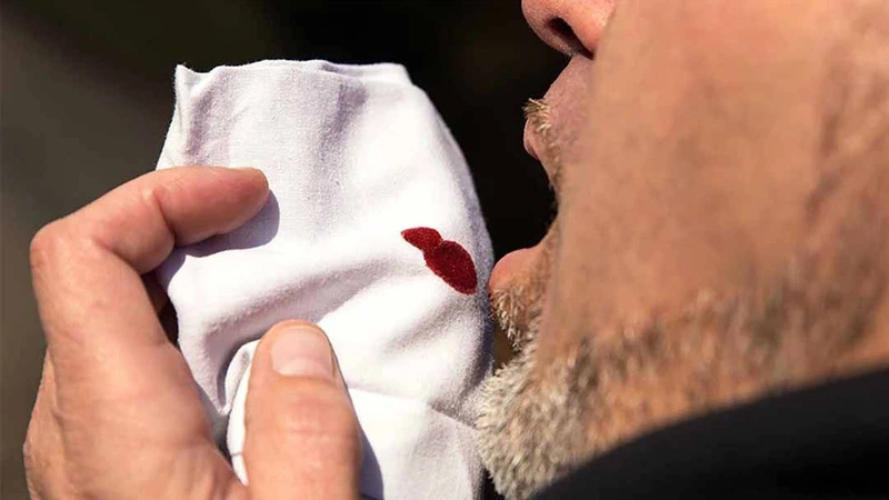 Viêm họng ho ra máu: Bệnh nguy hiểm không nên chủ quan 2
