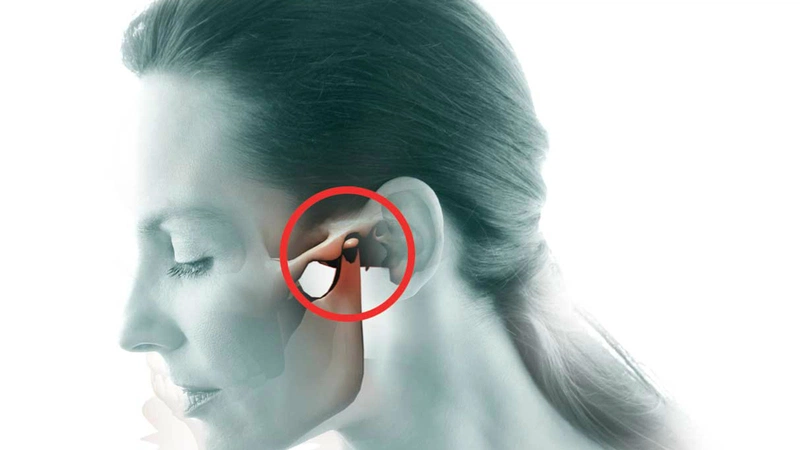 Viêm khớp thái dương hàm nổi hạch nguy hiểm ra sao? 1