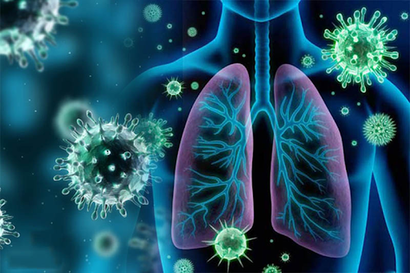 Những thông tin cần thiết về viêm phế quản phổi ở người lớn