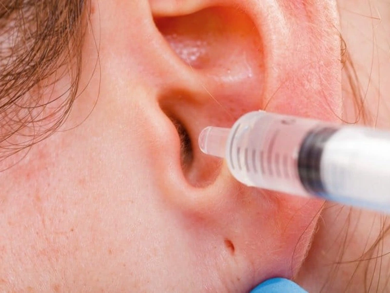 Viêm tai giữa có nên ngoáy tai không? 2