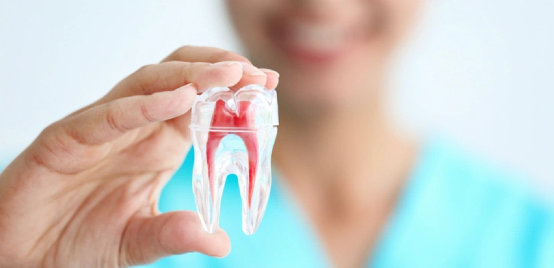 Viêm tủy răng là gì? Viêm tuỷ răng có tự khỏi không