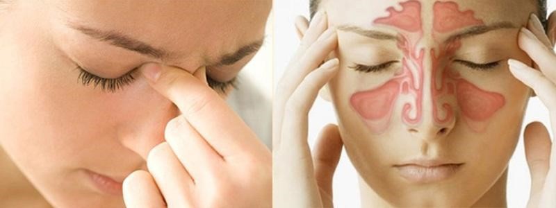 Viêm xoang có nên mổ không và khi nào thì cần mổ? 1