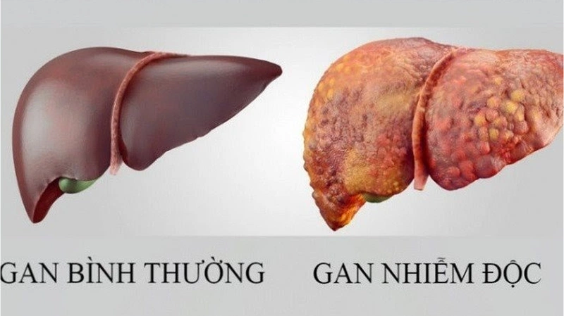 Viên uống giải độc gan Good Health Liver Tonic 17500 60V có tốt không?