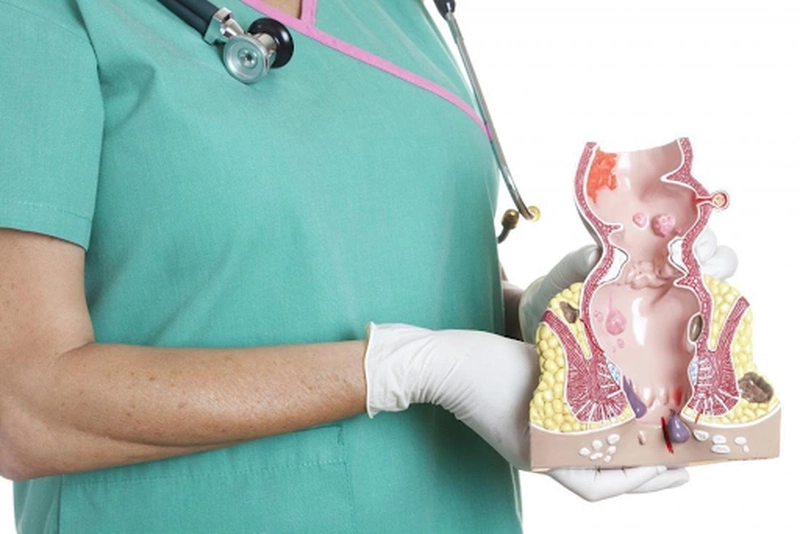 Những tác hại không ngờ của bệnh trĩ đến sức khỏe của bạn 2
