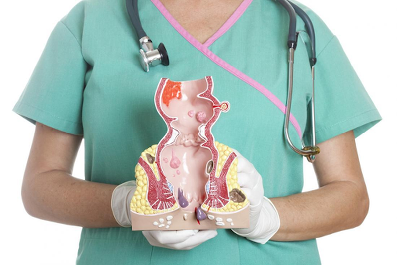 Bệnh trĩ: Dấu hiệu, phân loại và cách phòng ngừa hiệu quả 4