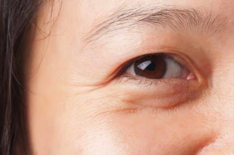 Vitamin C có vai trò gì trong cơ thể của chúng ta? 2