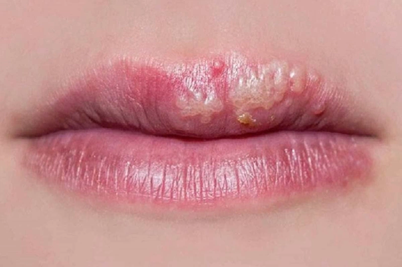 Xăm môi có hại không  Thu Cúc Sài Gòn