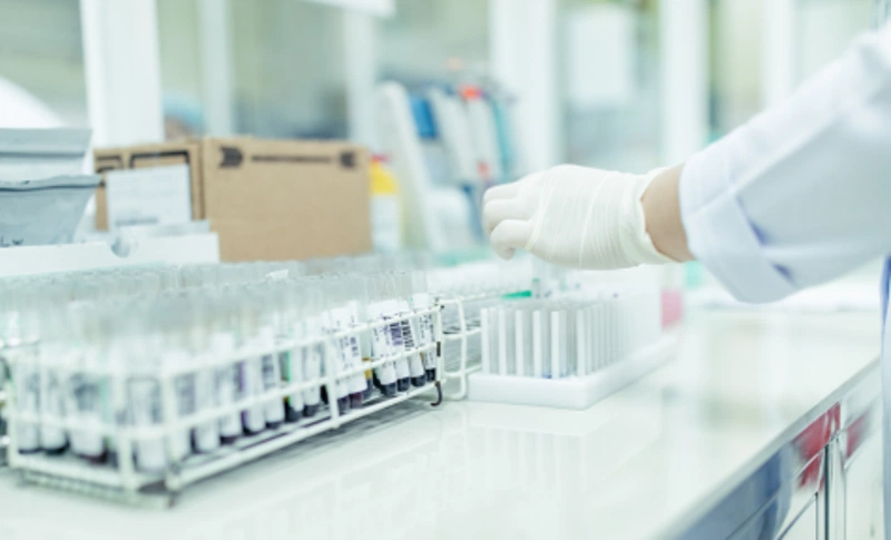 Xét nghiệm PCR lao