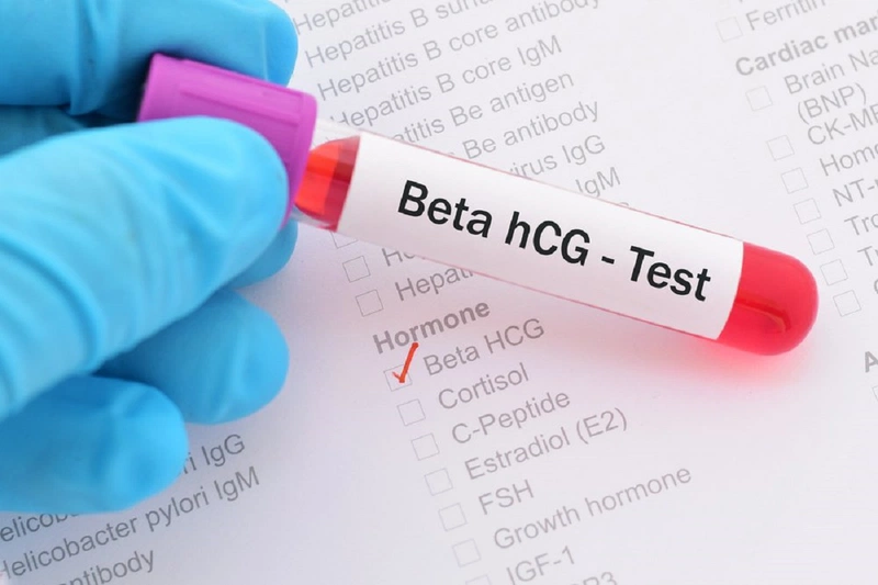 Xét nghiệm beta HCG là gì Có cần thiết không 1