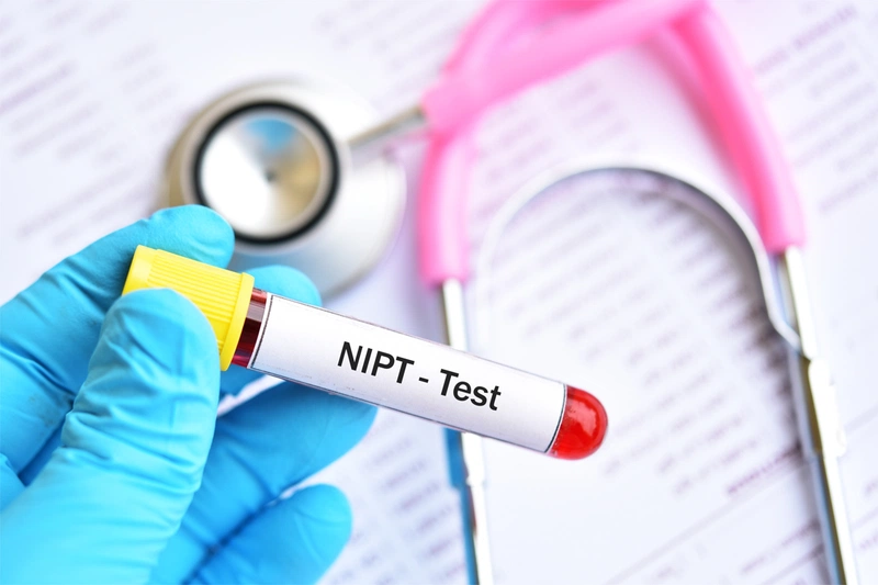 Xét nghiệm dị tật thai nhi bao nhiêu tiền?3