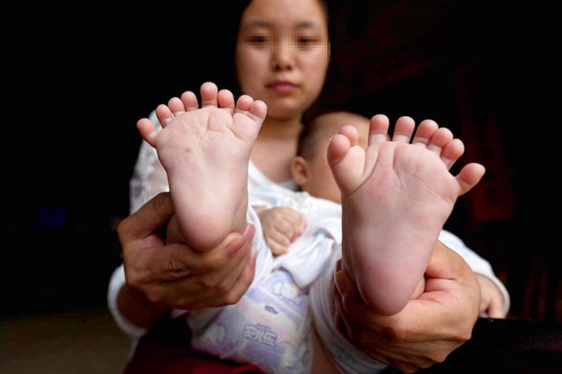 Có thai nên xét nghiệm dị tật thai nhi ở tuần thứ mấy