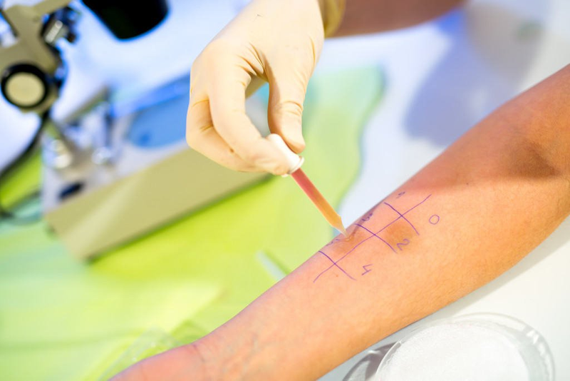 Xét nghiệm dị ứng da và những điều bạn nên biết 2
