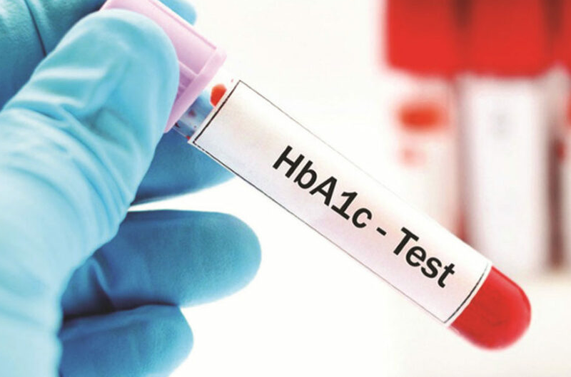 Xét nghiệm HbA1c là gì? Lưu ý gì khi làm xét nghiệm HbA1c 1