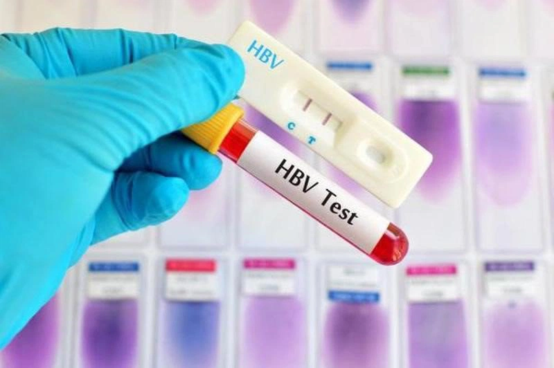 Kết quả xét nghiệmHBeAg cho biết tình trạng hoạt động của virus viêm gan B