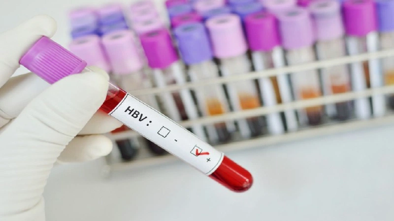 Xét nghiệm HBV nếu bạn xuất hiện các triệu chứng và dấu hiệu liên quan đến bệnh gan cấp tính