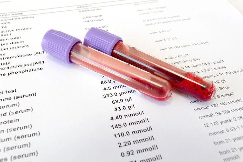 Một trong những xét nghiệm viêm gan B phổ biến nhất là xét nghiệm HBeAB