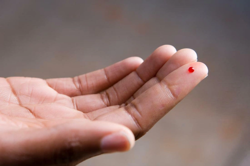 Xét nghiệm HIV bao lâu có kết quả? Giải đáp những thắc mắc về xét nghiệm HIV 2