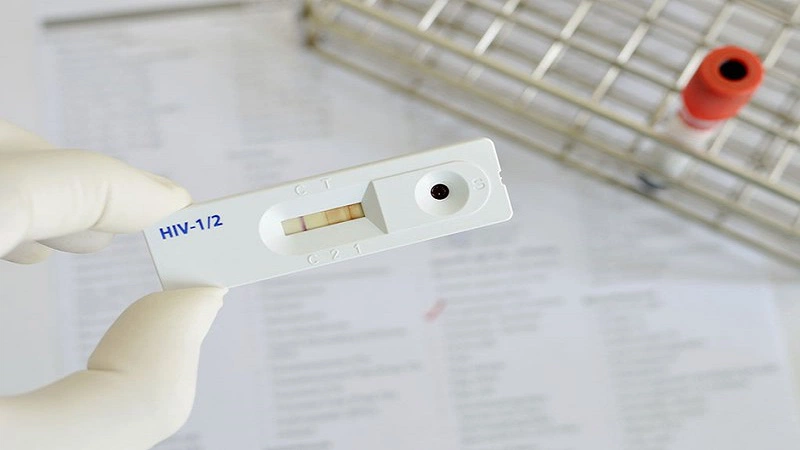 Kết quả xét nghiệm dương tính có nghĩa là đã phát hiện kháng thể và kháng nguyên HIV