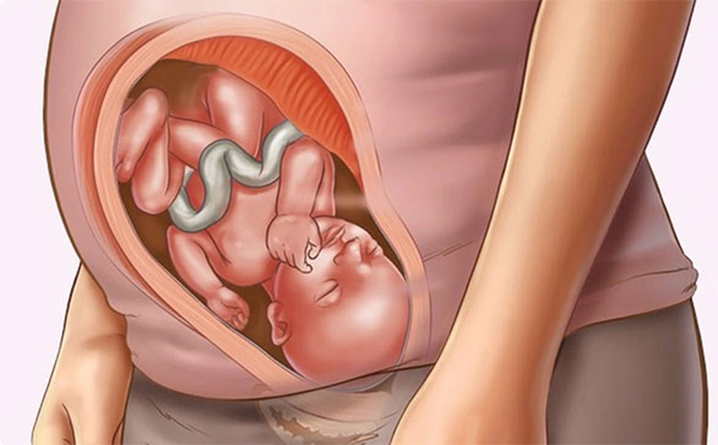 Xét nghiệm nipt bao lâu có kết quả? Chi phí xét nghiệm bao nhiêu tiền? 4