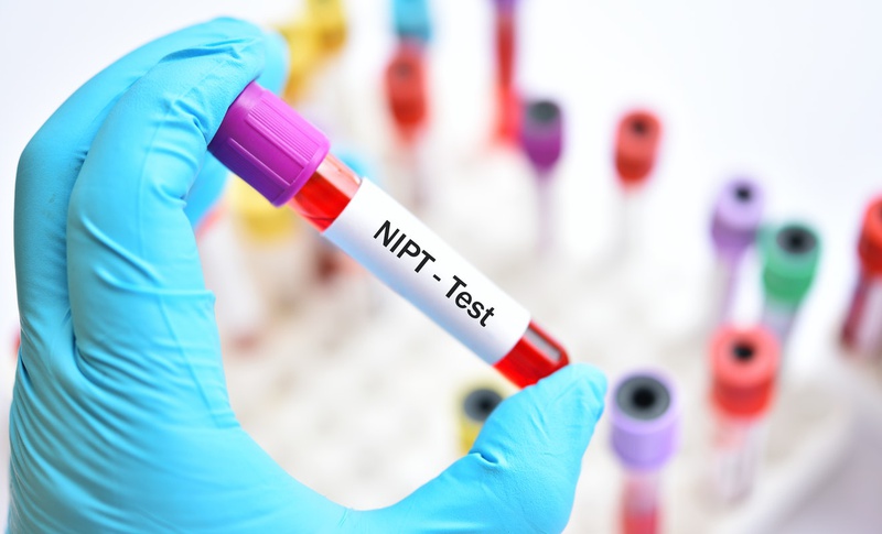 Kết quả xét nghiệm NIPT và những điều mẹ bầu cần biết 2