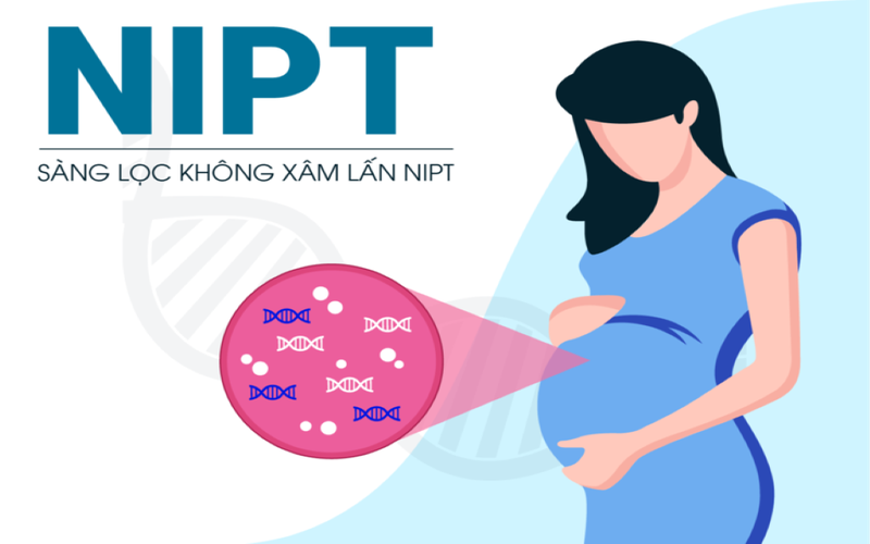 Xét nghiệm NIPT là gì? Những điều cần biết về xét nghiệm NIPT 1