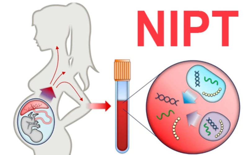Xét nghiệm NIPT là gì? Những điều cần biết về xét nghiệm NIPT 2